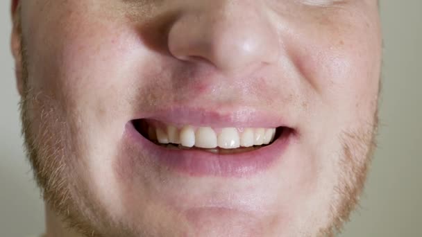 完美的阳刚笑容牙齿修复后 健康的洁白整齐的牙齿的概念 牙科医生笑了 — 图库视频影像