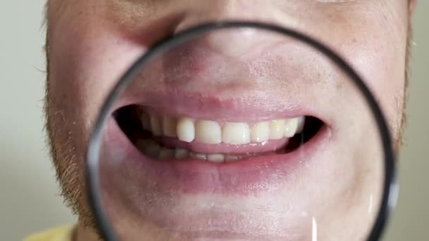 Jovem Demonstra Belos Dentes Brancos Através Uma Lupa Belo Sorriso — Vídeo de Stock