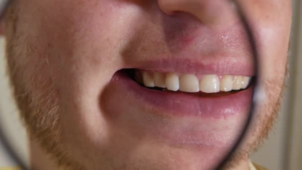 拡大鏡を通して完璧な白い歯を示す男 復元後の歯 健康的な白いよく手入れされた歯の概念 歯医者さんの笑顔 — ストック動画