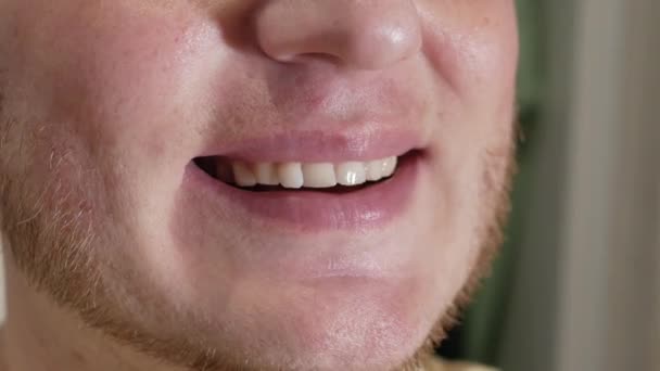 귀여운 남성의 미소를 클로즈업합니다 남자는 아름다운 치아를 줍니다 치과에서 — 비디오