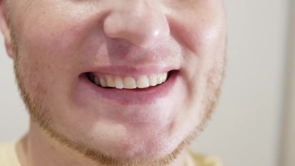男は喜んで笑う 信じられないほどかわいい男性の笑顔を閉じる その男は美しい白い歯を見せる 歯医者での修復後の歯 歯科医療の概念 — ストック動画