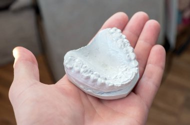Gypsum human teeth, teeth model for caps. or aligner.