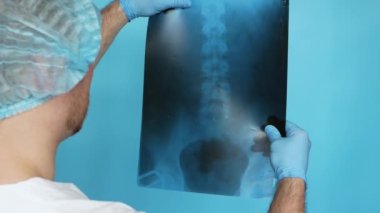 A medical doctor in a white coat in a cap with a sterile medical, analyzes an x-ray of the human spine on a blue background. A medical worker holds an x-ray of the spine of a hernia in his hands