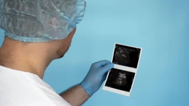 Doctor Shows Patient Operating Room Calculus Ultrasound Medical Worker Analyzes — Video Stock