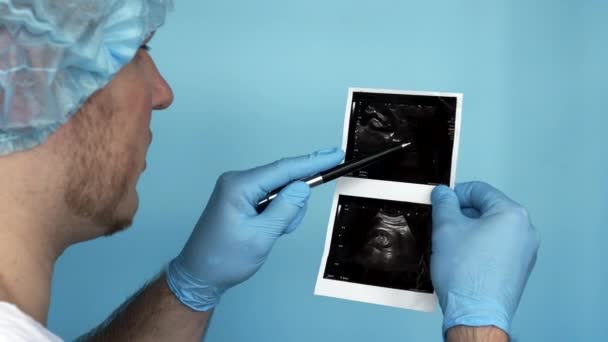 Doctor Shows Patient Operating Room Calculus Ultrasound Medical Worker Analyzes — Wideo stockowe