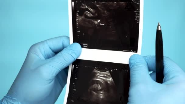 Közelkép Orvos Megvizsgálja Műtőben Elemzi Ultrahang Egy Vagy Számítás Emberi — Stock videók