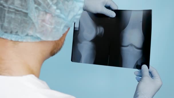 膝のX線で医者 医者は超音波検査で人の膝の損傷を分析する 手にX線のある病院の医療従事者 — ストック動画