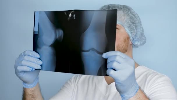 膝のX線で医者 医者は超音波で人の膝の傷害を注意深く分析する 手にX線のある病院の医療従事者 — ストック動画