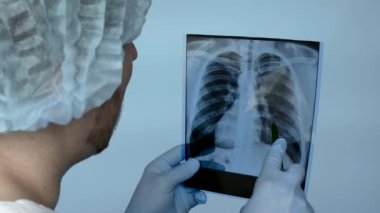 Close-up, Doctor with lung x-ray. A doctor carefully analyzes an x-ray of a person's lungs in a hospital. Lung injury on ultrasound. Health concept.