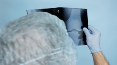 The doctor looks at the x-ray of the knee joint. The doctor in the operating room analyzes a man's knee injury. Health concept. Uzi cups of the woman's knee