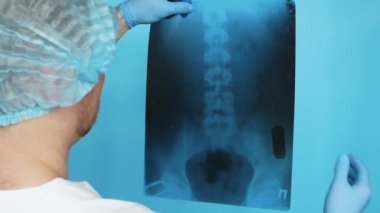 A medical doctor in a white coat in a cap with a sterile medical, analyzes an x-ray of the human spine on a blue background. A medical worker holds an X-ray of the spine in his hands