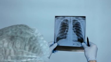 Close-up, Doctor with a pen in his hand with an x-ray of the lungs in the operating room. A doctor carefully analyzes an x-ray of a person's lungs in a hospital. Lung damage on ultrasound, pneumonia. Health.