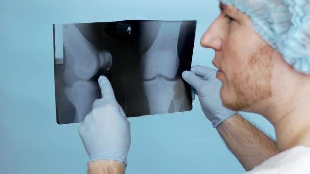 Doctor Con Radiografía Rodilla Médico Analiza Cuidadosamente Lesión Rodilla Una — Vídeo de stock