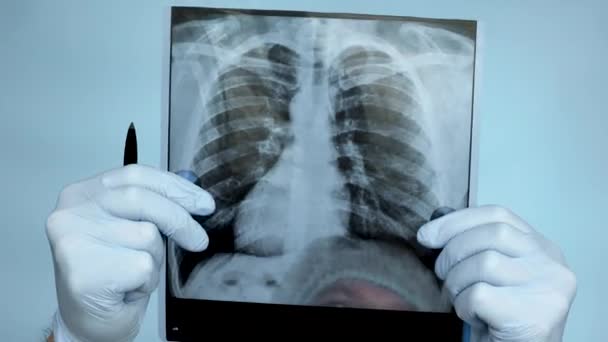 Gros Plan Docteur Avec Une Radiographie Des Poumons Dans Ses — Video