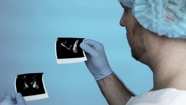医療用のガウンを着た若い医者と男性の前立腺腺の超音波滅菌手袋のキャップ 医師は ヒト前立腺腺腫の超音波を分析します 可能性だ 健康的なコンセプト — ストック動画