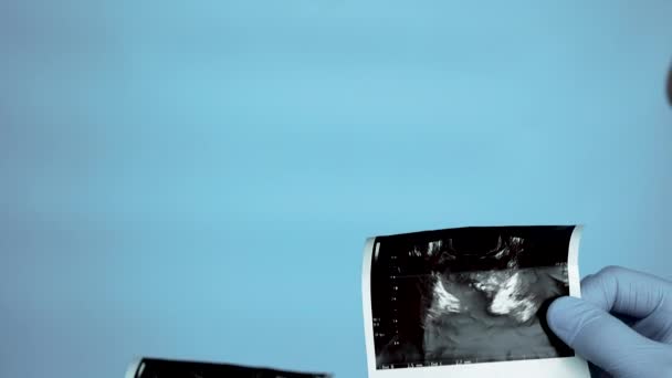 超音波をクローズアップ 滅菌手袋の医師 男の前立腺腺の超音波 医師は ヒト前立腺腺腫の超音波を分析します 可能性だ 健康的なコンセプト — ストック動画