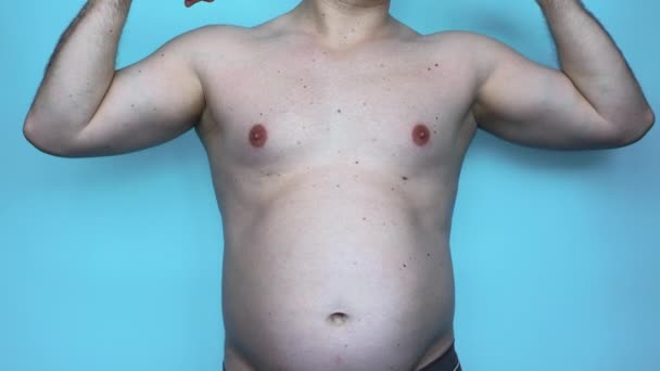 Людина Ожирінням Демонструє Біцепси Язів Шкіра Товстої Молодої Людини Люди — стокове відео