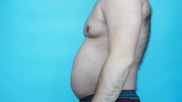 Сколіоз Хребта Людина Викривленням Хребта Торсо Чоловіка Ожирінням Поставою Правильним — стокове відео
