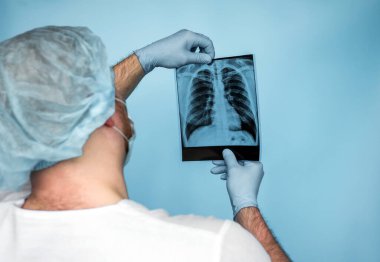 Tüberküloz. Akciğer kanseri. Bir doktor, akciğerlerin röntgenini dikkatlice inceler. Bir doktor ultrasonda zatürreeyi, solunum hastalığını inceler. Akciğer komplikasyonu.