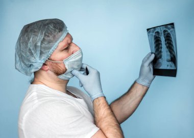 Tüberküloz. Akciğer kanseri. Bir tıp çalışanı röntgeni analiz eder, bir radyograf akciğerlerin röntgenini dikkatlice inceler, bir doktor zatürreeyi, bir solunum hastalığını dikkatle inceler. Akciğer komplikasyonu
