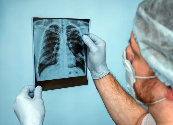 stock image Tuberculosis. Lungs' cancer. A medical worker radiographer in uniform carefully takes an x-ray of the lungs, a doctor examines pneumonia, a respiratory disease. Pulmonary complication.