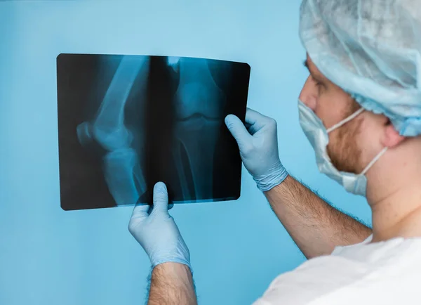 Diagnosis Bone disease. Doctor traumatologist otoped analyzes a knee injury of a person\'s leg. X-rays of the doctor\'s knee are in his hands in the office. The doctor analyzes the damage to the leg injury on ultrasound.