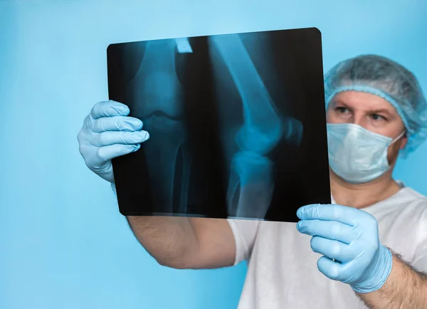 Bone disease. Doctor traumatologist otoped analyzes a knee injury of a person's leg. X-rays of the doctor's knee are in his hands in the office. The doctor analyzes the damage to the leg injury on ultrasound.