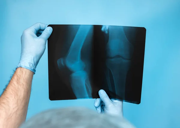 Diagnosis Human bone disease. Doctor traumatologist otoped analyzes a knee injury of a person's leg. X-rays of the doctor's knee are in his hands in the office. The doctor analyzes the damage to the leg injury on ultrasound.