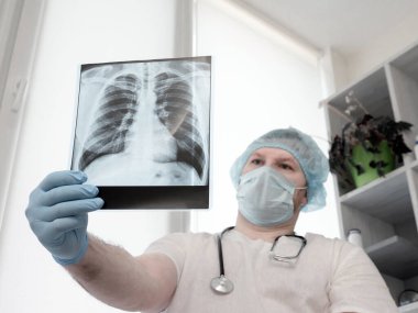 Tüberküloz. Akciğerlerin onkolojisi. Steteskoplu bir doktor akciğerlerin röntgenine bakar. Hastanedeki bir doktor da kişinin hastalığını analiz eder. Klinikteki radyografın ofisi. Enfeksiyon