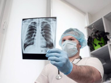 Tüberküloz. Akciğerlerin onkolojisi. Steteskoplu bir doktor akciğerlerin röntgenine bakar. Hastanedeki bir doktor da kişinin hastalığını analiz eder. Klinikteki radyografın ofisi. erkek bulaşıcı hastalıklar