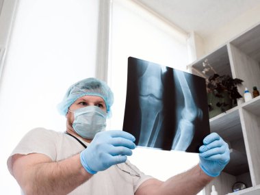 Klinikte üniformalı bir doktor. Travma uzmanı kırık bir bacağı analiz ediyor. Dizinin röntgeni. Ultrason. Diz ekleminde bacak yaralanması. Kemik erimesi