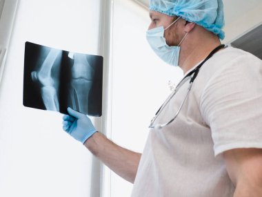 Doktor travmatolog kırık bir bacağı analiz ediyor. Dizinin röntgeni. Diz ekleminde bacak yaralanması. Kemik erimesi