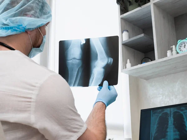 stock image Doctor radiographer, with a stethoscope in a medical uniform in a clinic in his office, a traumatologist analyzes a leg fracture. X-ray of the knee. Ultrasound. Injury of the leg in the knee joint. Osteoporosis