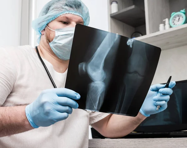 A doctor professional radiographer studies the disease, a doctor with a stethoscope in a hospital in his office, a traumatologist analyzes a broken leg. X-ray of the knee. Ultrasound. Injury of the leg in the knee joint. Osteoporosis
