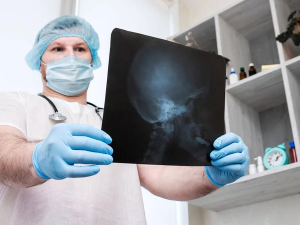 stock image Human skull on x-ray in doctor's hands. Doctor in the office studying diseases of the central and peripheral nervous system, a neurologist is studying the disease of the brain, a doctor with a stethoscope in the office