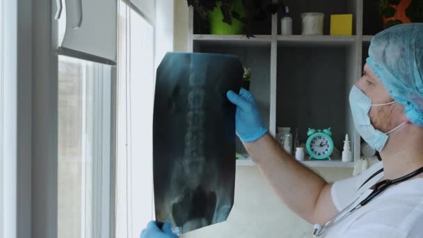 医者は病院で男の背中のX線を診断する 医師の手の中に人間の背骨のX線 病院での治療の概念 医師の医療援助 — ストック動画