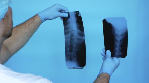 Лікар Діагностує Проблеми Хребтом Людини Рентгенівському Випромінюванні Лікарні Медичний Працівник — стокове відео