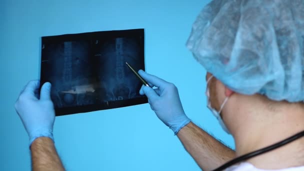 X線超音波で腎臓内のオキサレート微積分 医師の外科医の泌尿器科診断は慎重にヒト腎臓のX線 医師は尿管内のリン酸塩石を分析します 生殖器系疾患 — ストック動画
