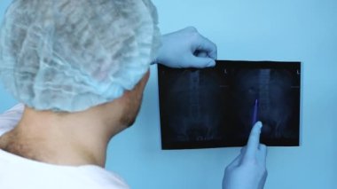 Böbrekte 8 mm 'lik bir kalkülüsün röntgeni. Üreterdeki taş röntgende. İnsan böbreklerinin ve omurgalarının röntgeni. Klinikteki doktor böbrek taşı hastalığı teşhisi koydu. Doktor hastalığı hastaya anlatır.
