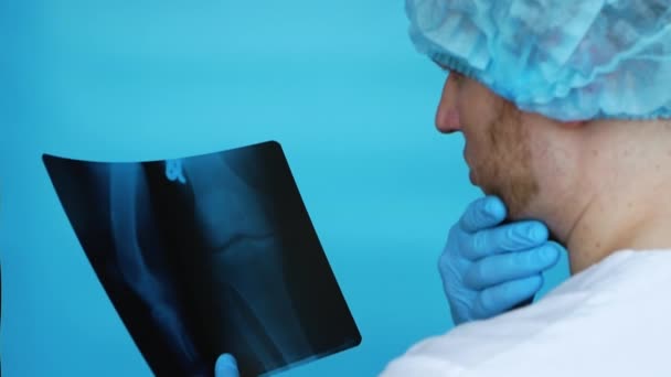 医者は人の膝のX線を診断する 膝の怪我だ 病院の医療従事者は 膝のX線を分析します 青い背景に制服を着た医者 — ストック動画