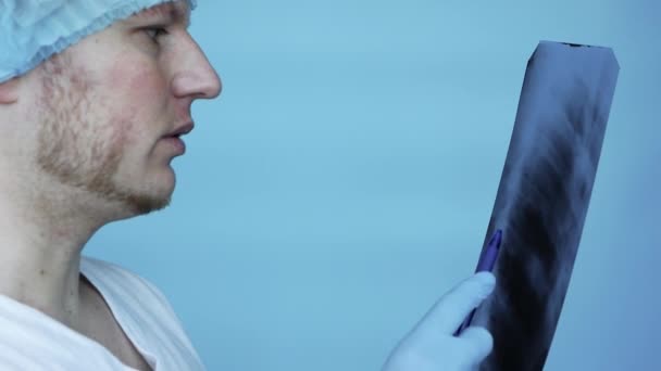 Rippenbruch Auf Einem Röntgenbild Diagnostiziert Der Arzt Die Rippen Einer — Stockvideo