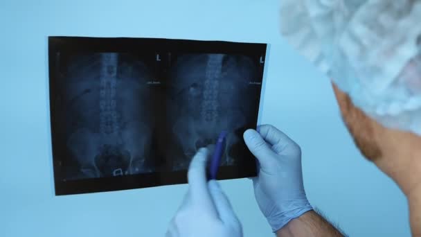 Rentgen Ludzkich Nerek Kręgosłupa Lekarz Klinice Diagnozuje Chorobę Kamieni Nerkowych — Wideo stockowe