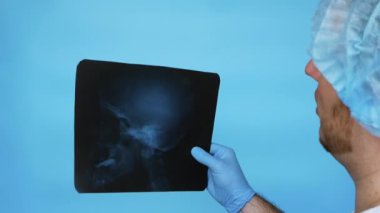 Beyin cerrahı insan kafatasını analiz eder. İnsan beyninin röntgeni doktorun elindeydi. Doktor, ofisindeki röntgende kafatasındaki yarayı analiz ediyor.