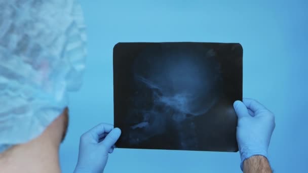 医師の手の中に人間の脳のX線 放射線技師医者は彼のオフィスでX線で頭蓋骨の損傷を分析します 頭蓋脳のX線を持つ外傷学者 — ストック動画