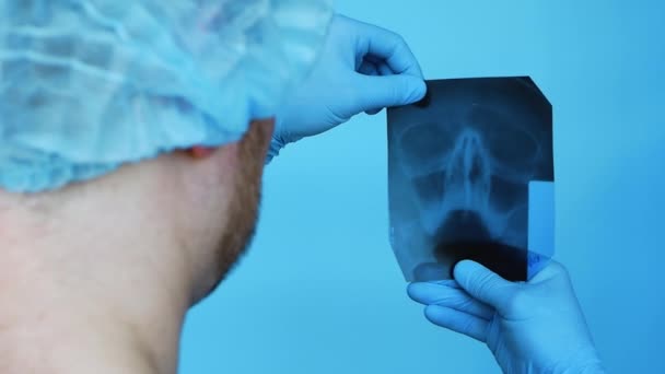 Primer Plano Médico Una Clínica Diagnostica Una Lesión Cabeza Nasofaringe — Vídeo de stock