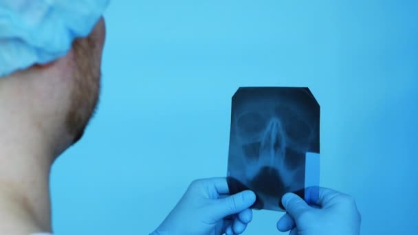 Lekarz Klinice Zdiagnozował Uraz Mózgu Prześwietlenie Ludzkiego Nosa Lekarz Diagnozuje — Wideo stockowe
