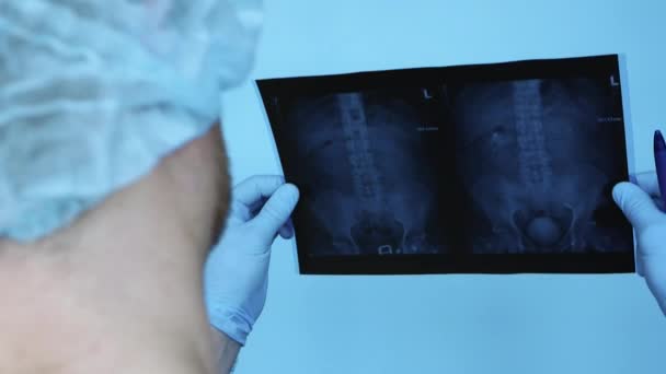 Radiographie Des Reins Humains Colonne Vertébrale Médecin Clinique Diagnostique Une — Video
