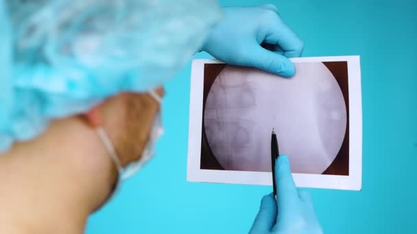 Urology Doctor Diagnosing Ultrasound Kidneys 8Mm Oxalate Stone Stuck Ureter — Stock Video