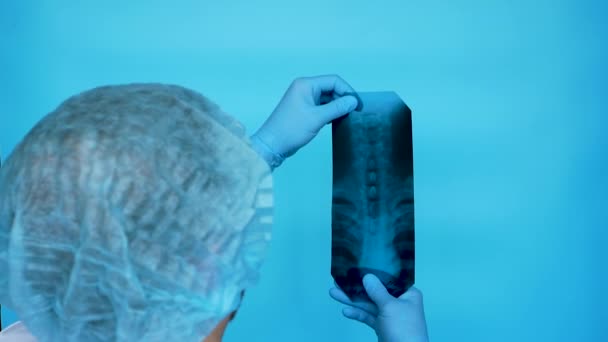 의사는 병원에서 엑스레이를 환자의 척추에 문제가 있다고 병원의 종사자가 경피증 — 비디오