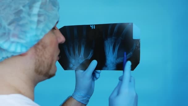 医師の手の中に男の手首のX線 医師はX線で人の指の損傷を分析します 外傷学者は病院でX線を手に人間の解剖学の講義をする — ストック動画